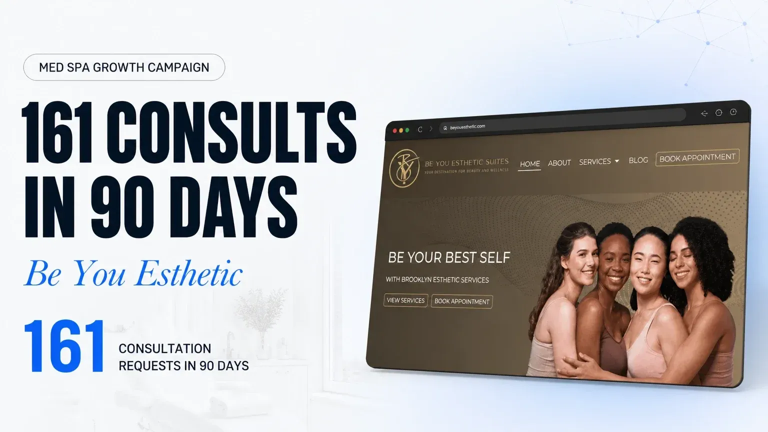Be You Esthetic case-study card showing their website, headline “161 CONSULTS IN 90 DAYS”. 161 CONSULTATION REQUESTS IN 90 DAYS